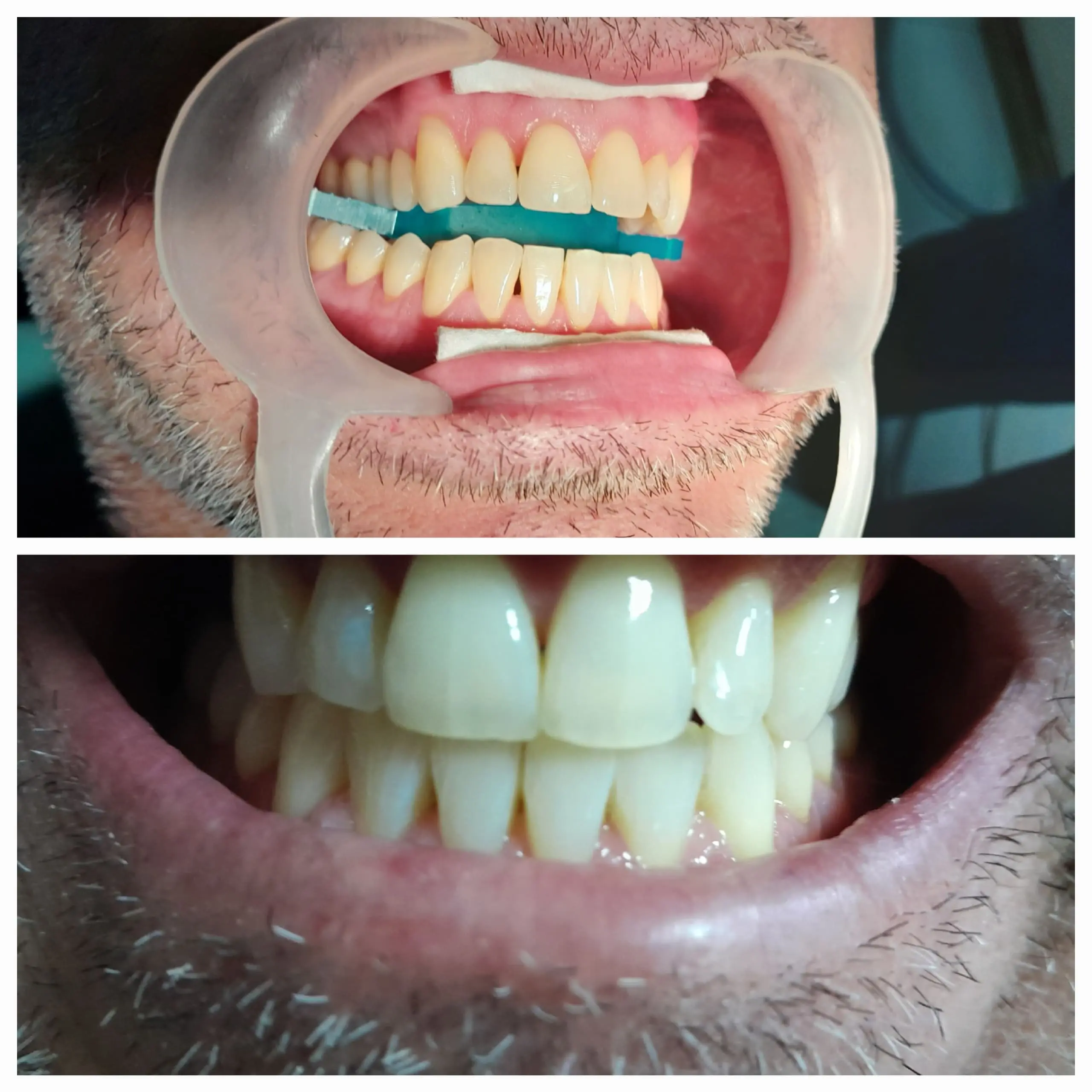 Patient Smile